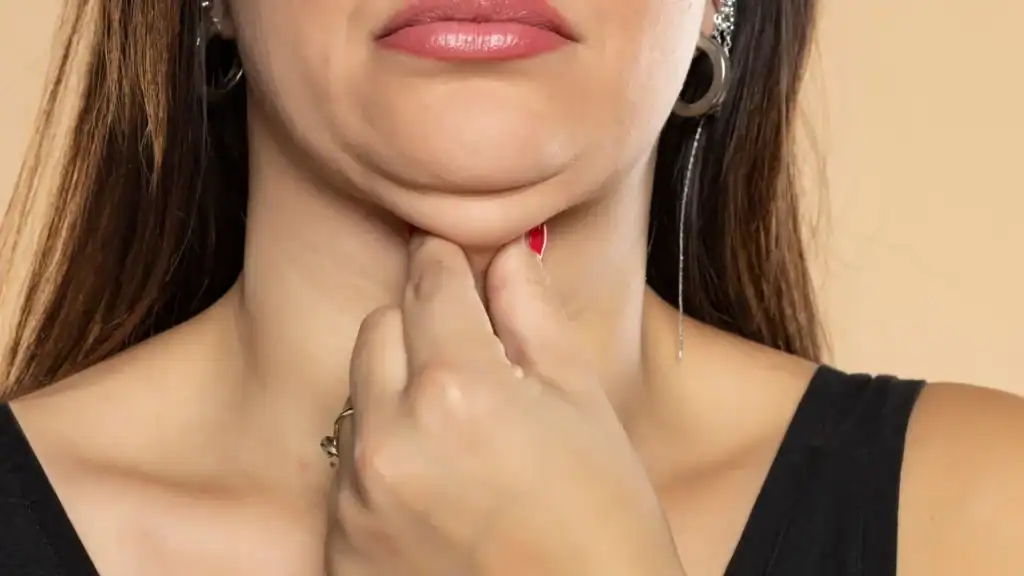 An image of a woman with double chin, sad, worried : Non Surgical Double Chin Removal Treatment in Stratford, UK