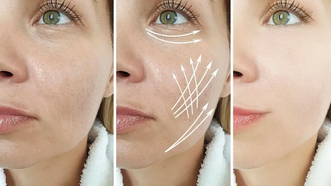 Can One Treatment Really Tackle More Than One Skin Concern Stratford?