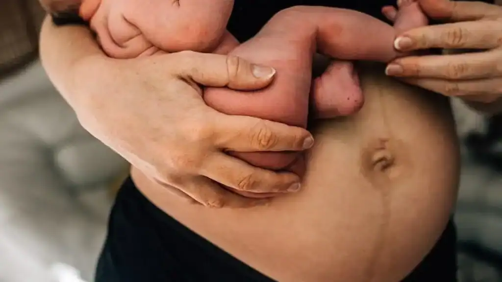 Why Is My Stomach Still Big After Pregnancy Stratford?
